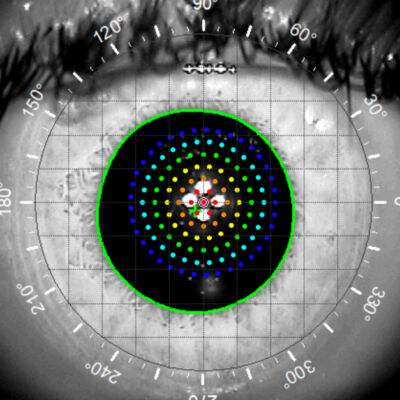 normal eye ray trace